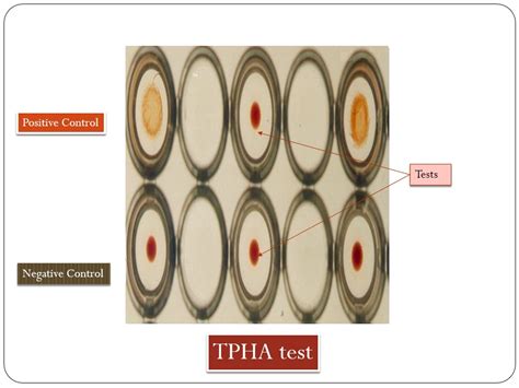 TPHA (Quantitative) / Lab@Home .